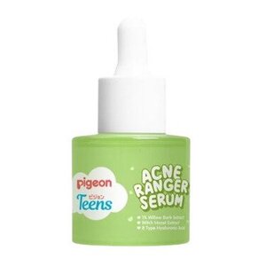 CEK BPOM Pigeon Teens Acne Ranger Serum